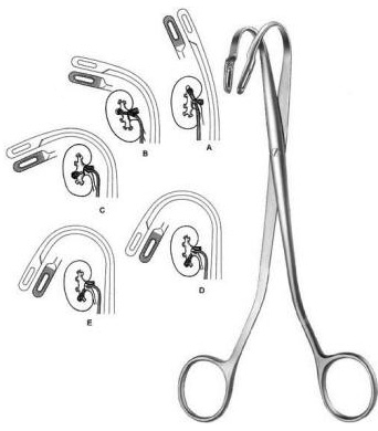 Kidney Stone Forceps